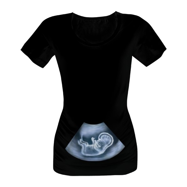 Tričko s potiskem Těhotenské tričko - ultrazvuk
